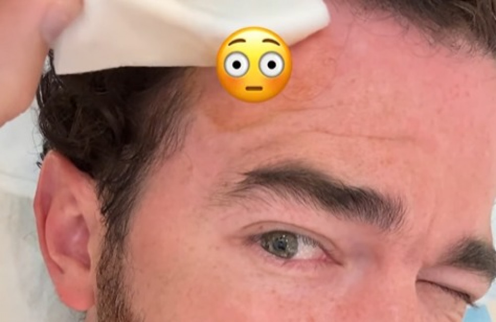 Kevin Jonas skin cancer removal Instagram ONE USE Kevin Jonas skin cancer removal Instagram ONE USE